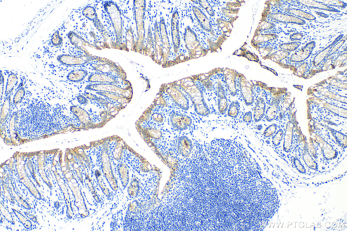 IHC staining of mouse colon using 83111-1-RR (same clone as 83111-1-PBS)