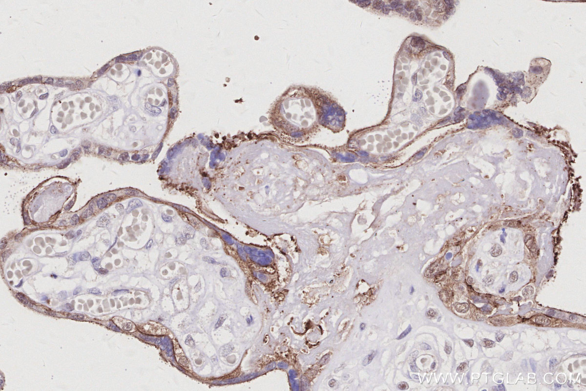 IHC staining of human placenta using 83111-4-RR