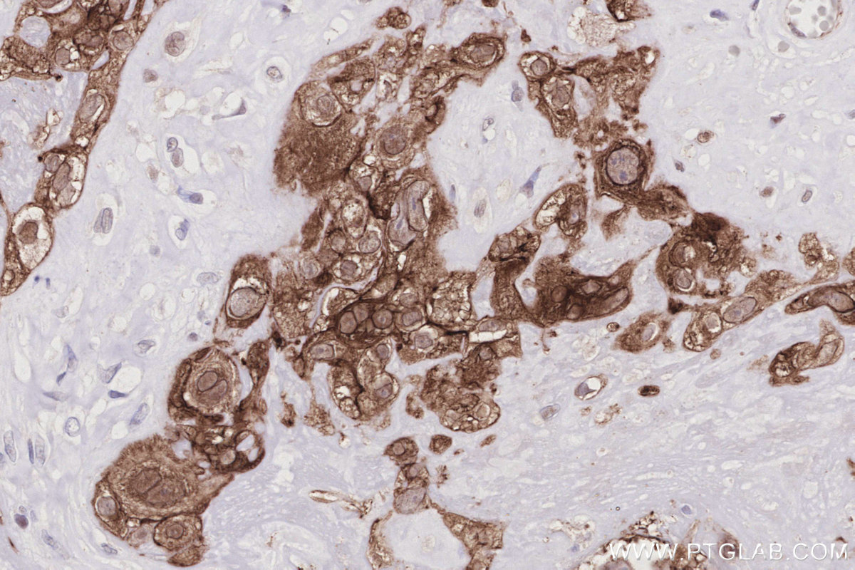 IHC staining of human placenta using 83111-4-RR