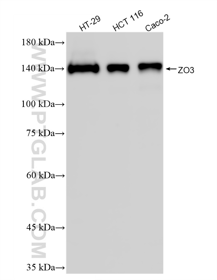 WB analysis using 87266-1-RR WB analysis using 87266-1-RR