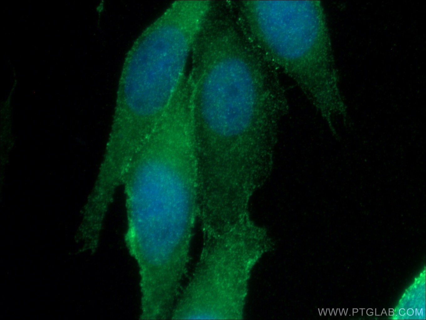 zo-1-antibody-21773-1-ap-proteintech