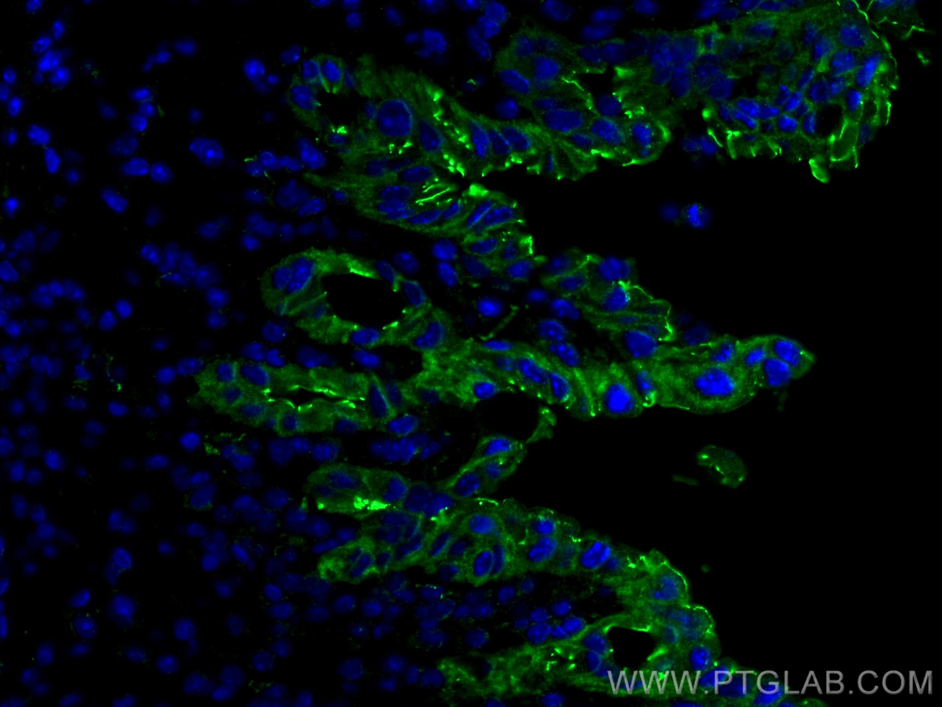 zo-1-antibody-21773-1-ap-proteintech