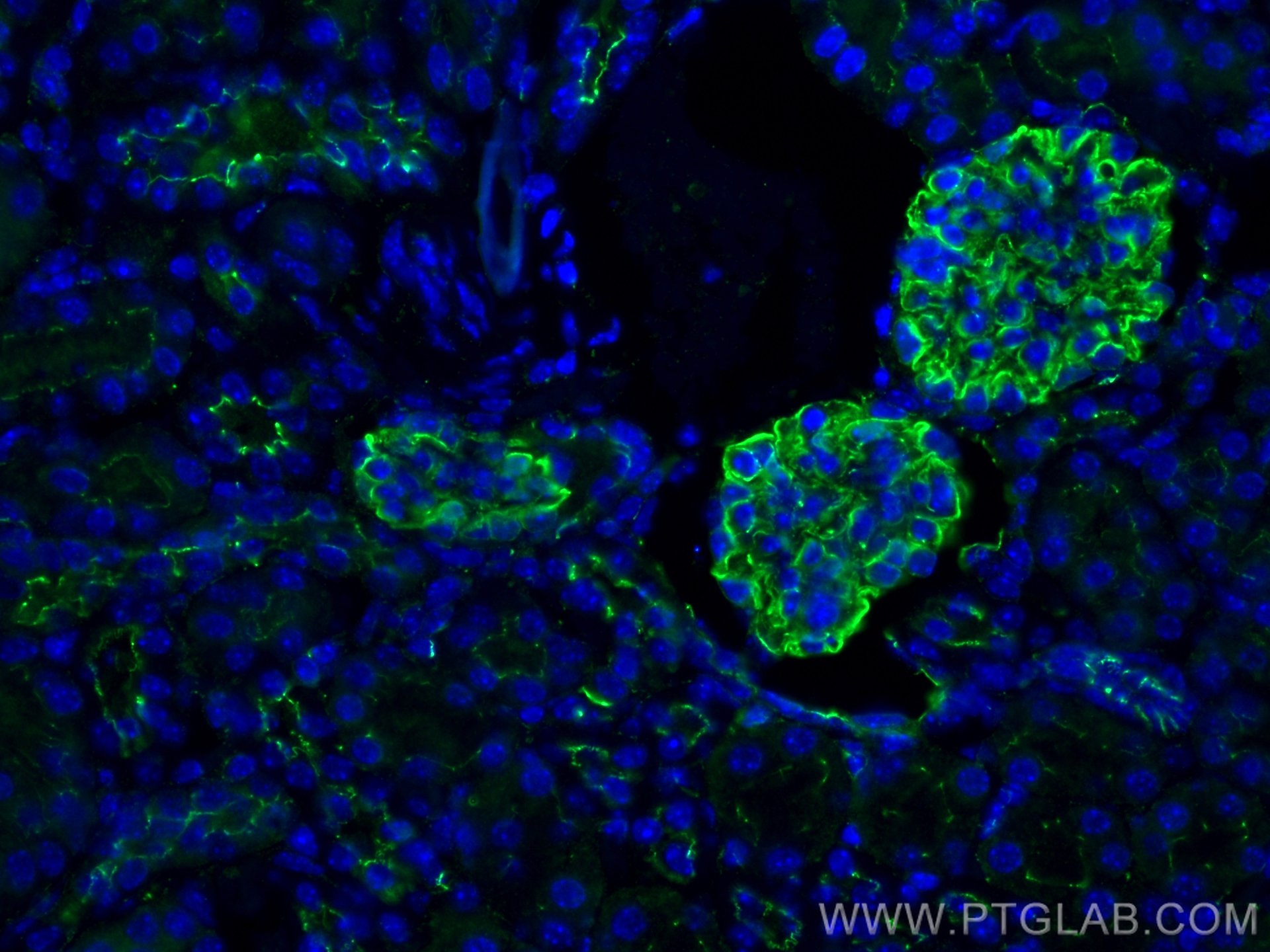 zo-1-antibody-21773-1-ap-proteintech