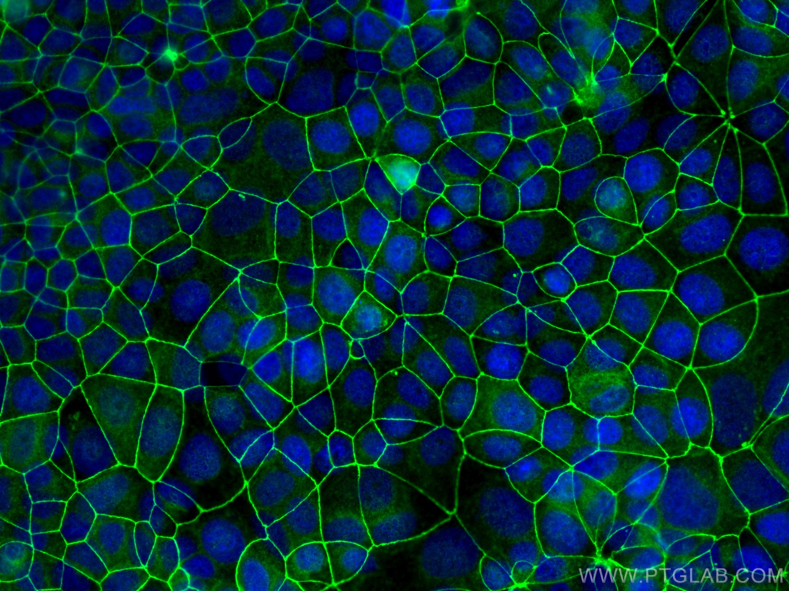 zo-1-antibody-21773-1-ap-proteintech