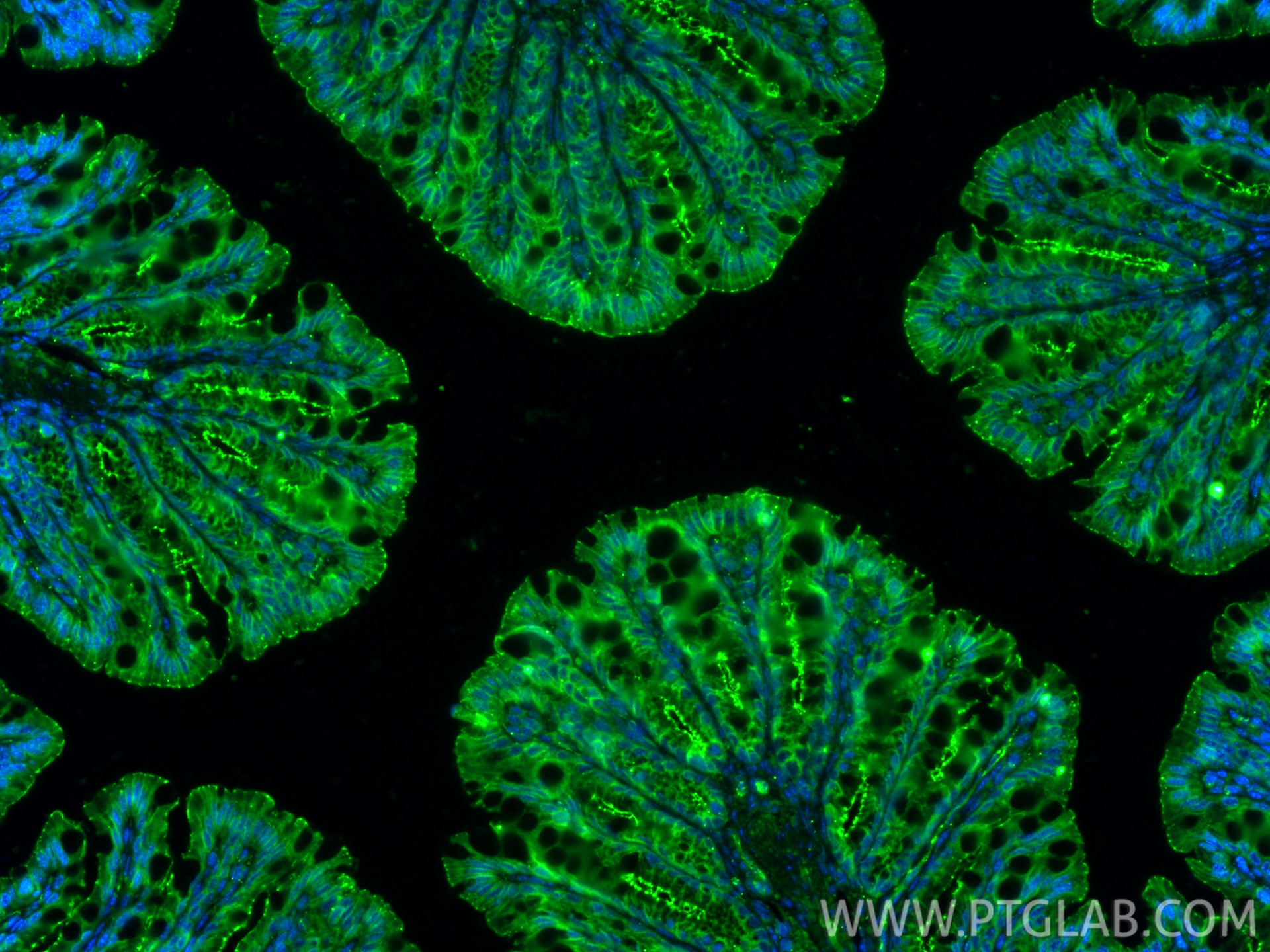 IF Staining of mouse colon using 21773-1-AP