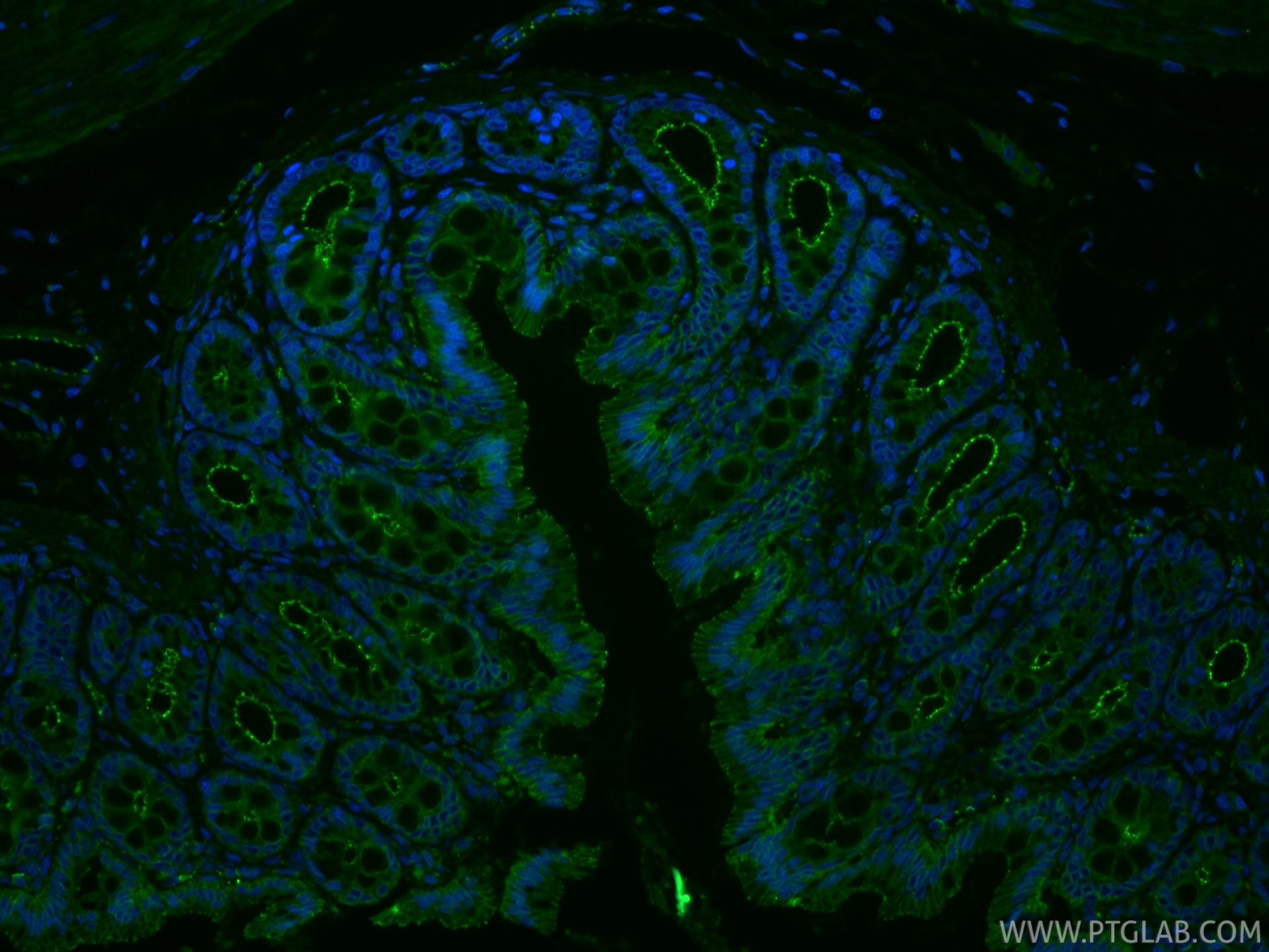 IF Staining of rat colon using 21773-1-AP IF Staining of rat colon using 21773-1-AP