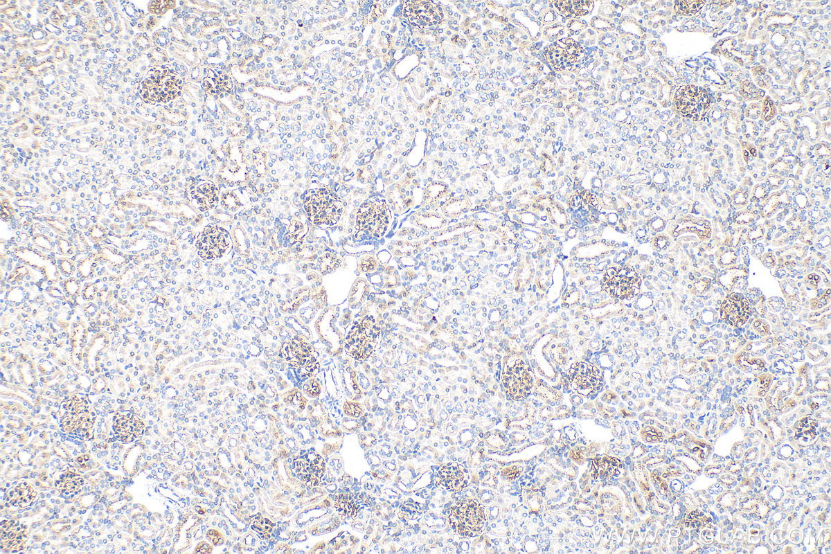 IHC staining of mouse kidney using 21773-1-AP