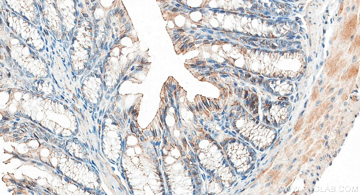 IHC staining of mouse colon using 21773-1-AP