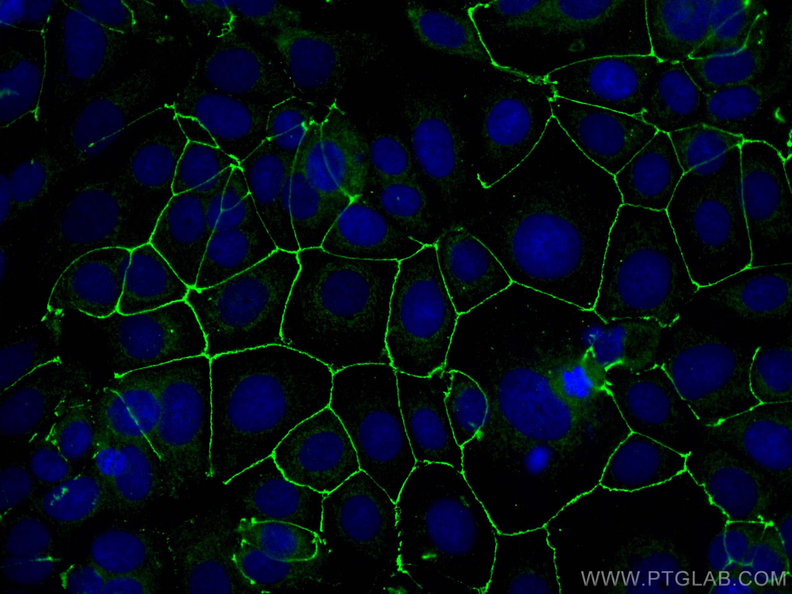 IF Staining of MCF-7 using 30487-1-AP