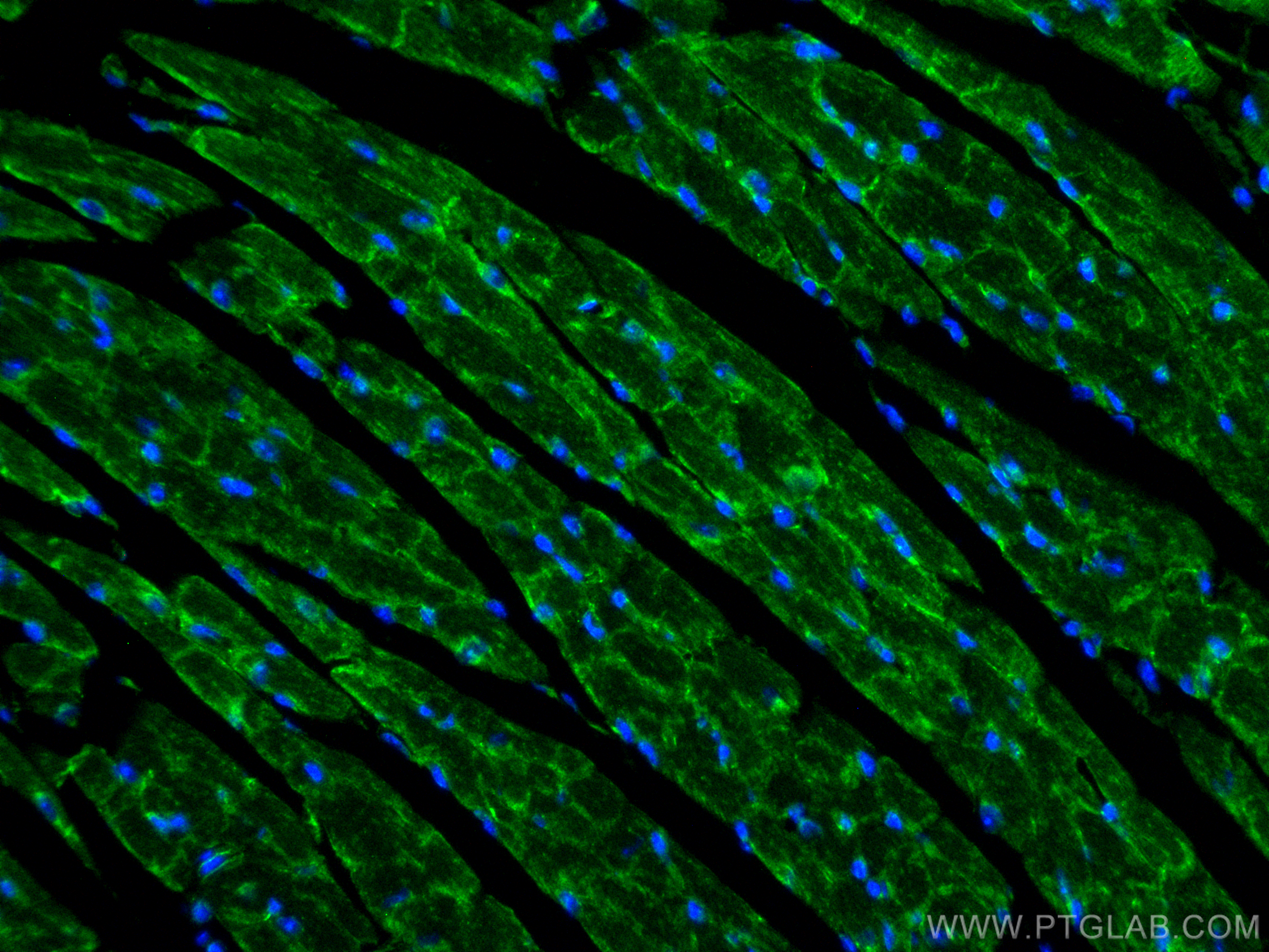 IF Staining of mouse heart using 82870-1-RR (same clone as 82870-1-PBS)