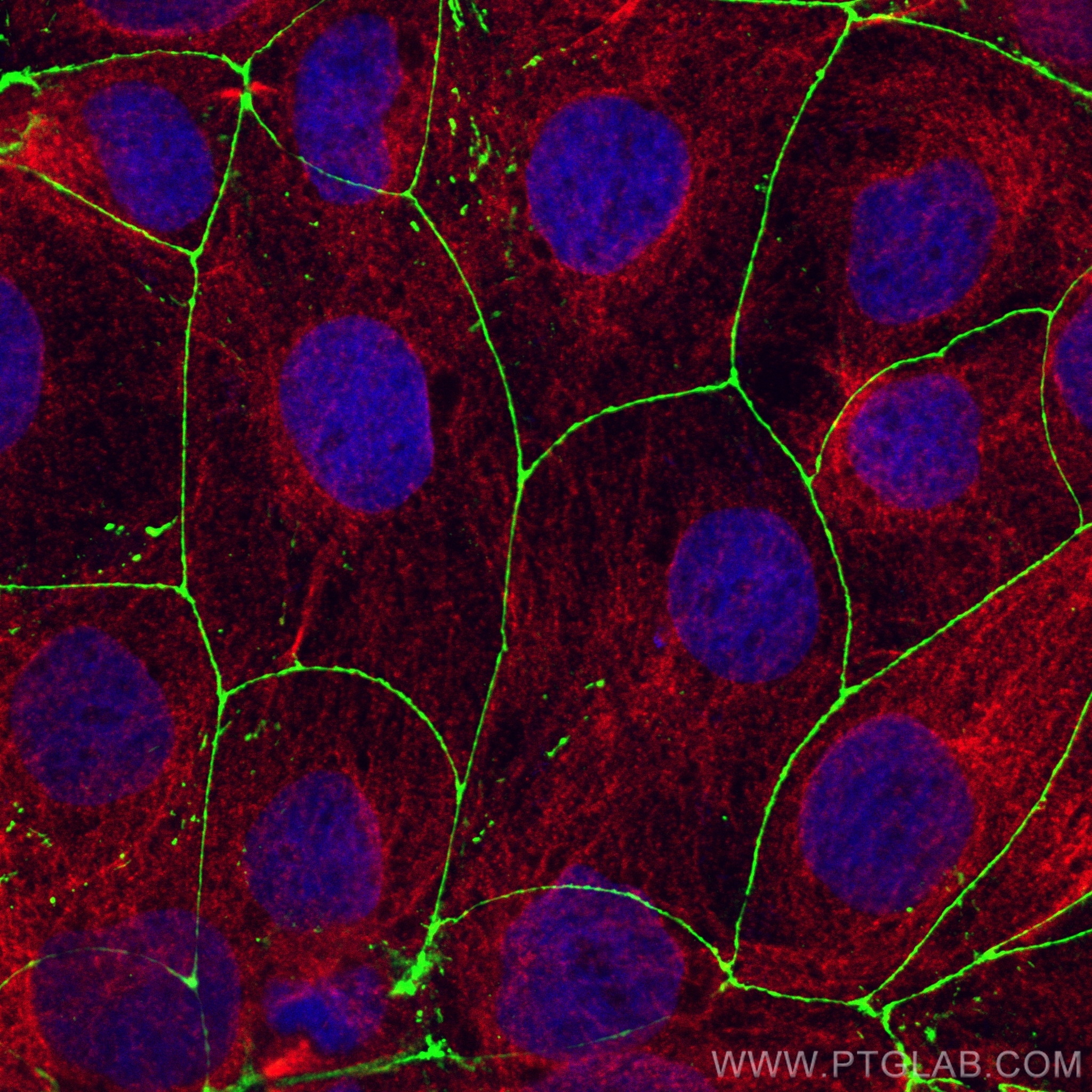 IF Staining of Caco-2 using 82870-7-RR