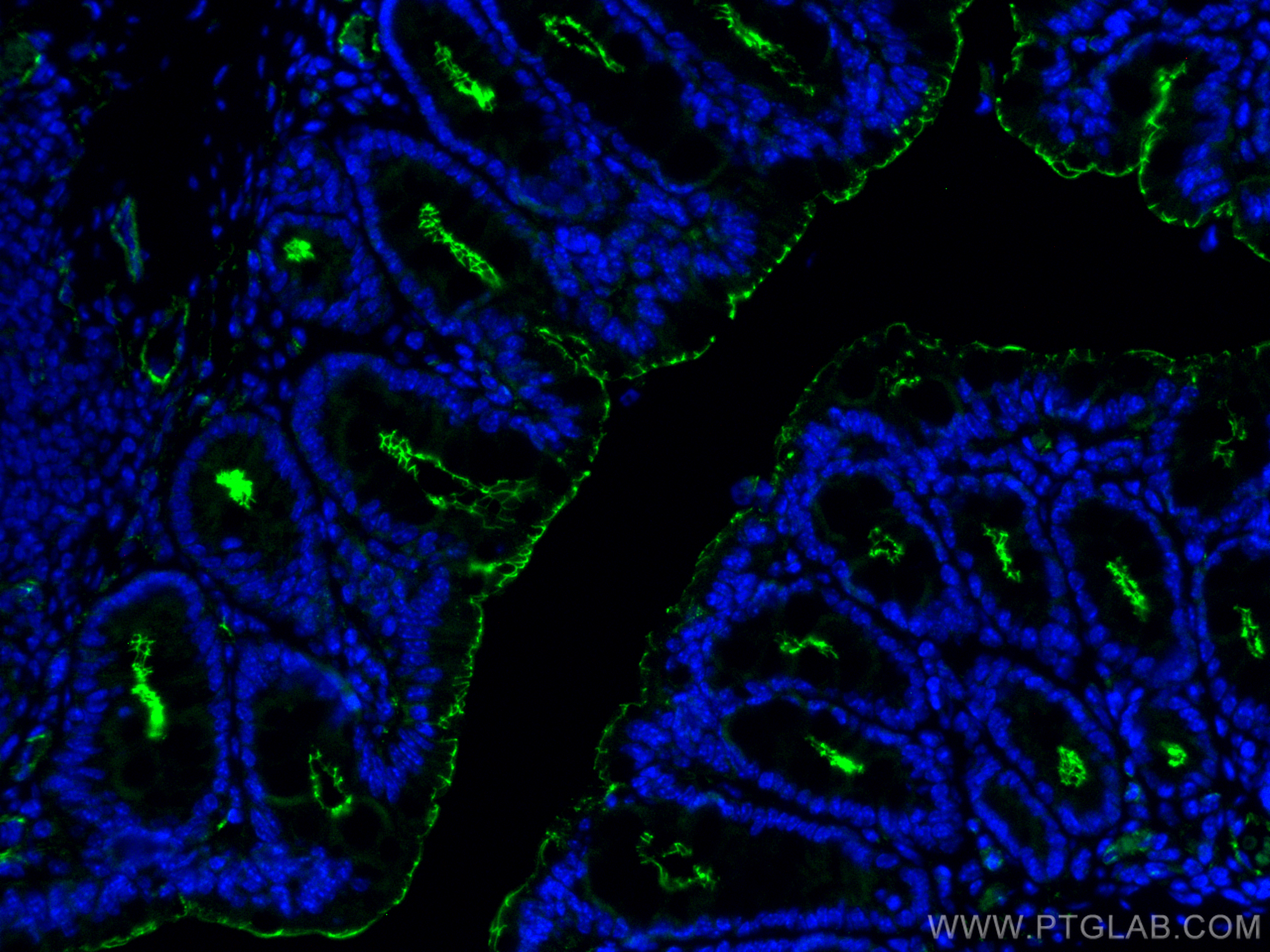 IF Staining of mouse colon using 82870-7-RR