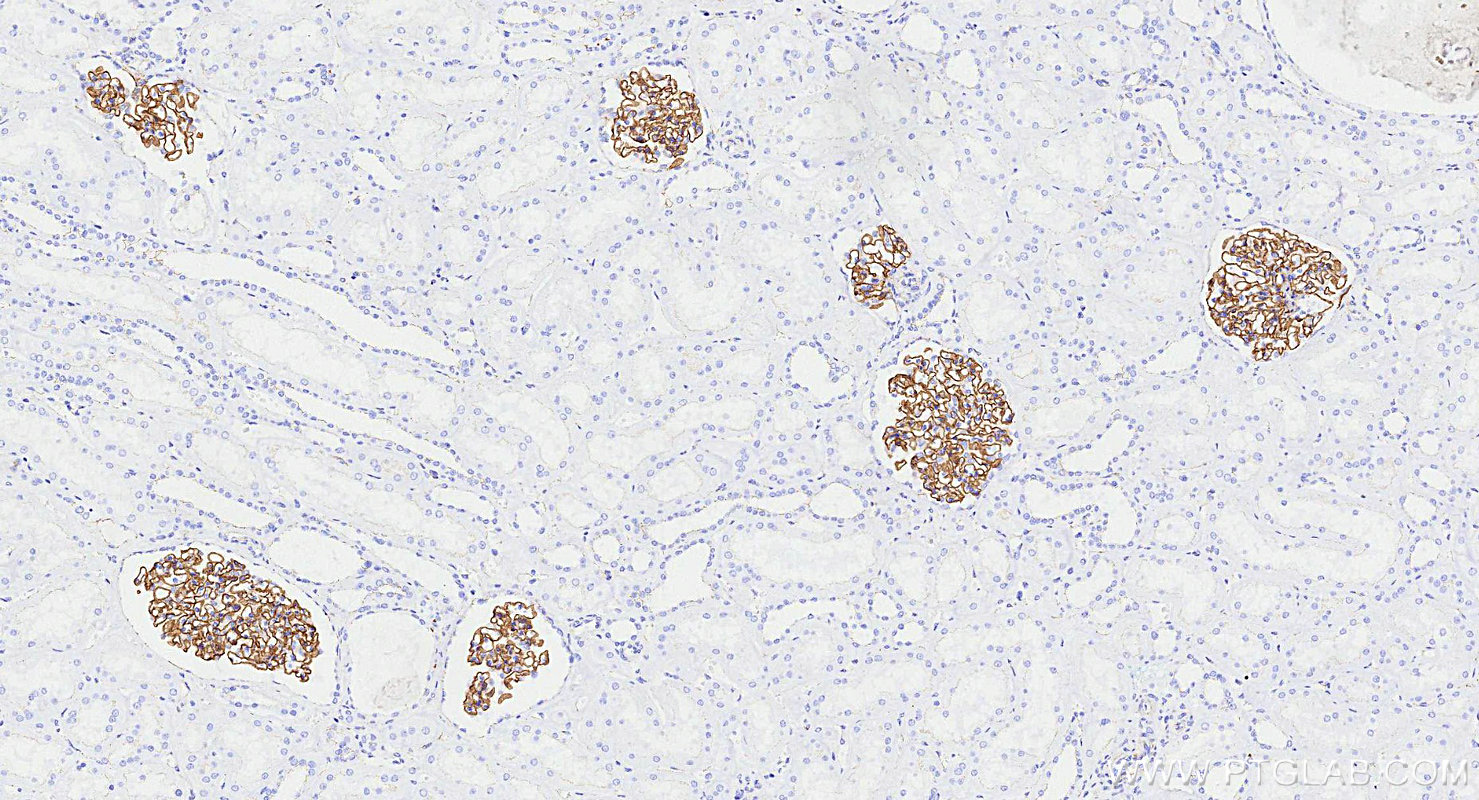 IHC staining of human kidney using 82870-7-RR (same clone as 82870-7-PBS)