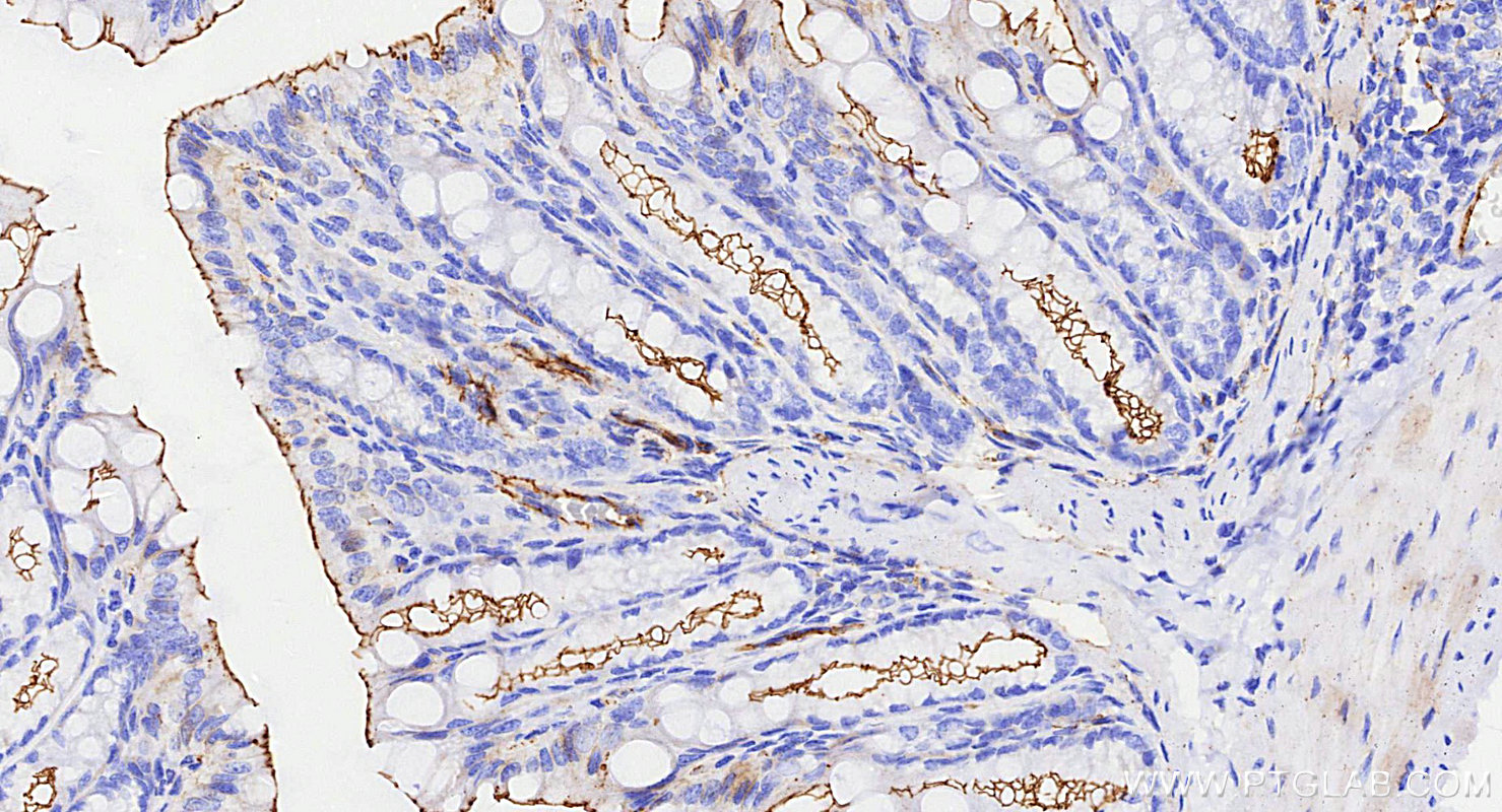 IHC staining of mouse colon using 82870-7-RR (same clone as 82870-7-PBS)