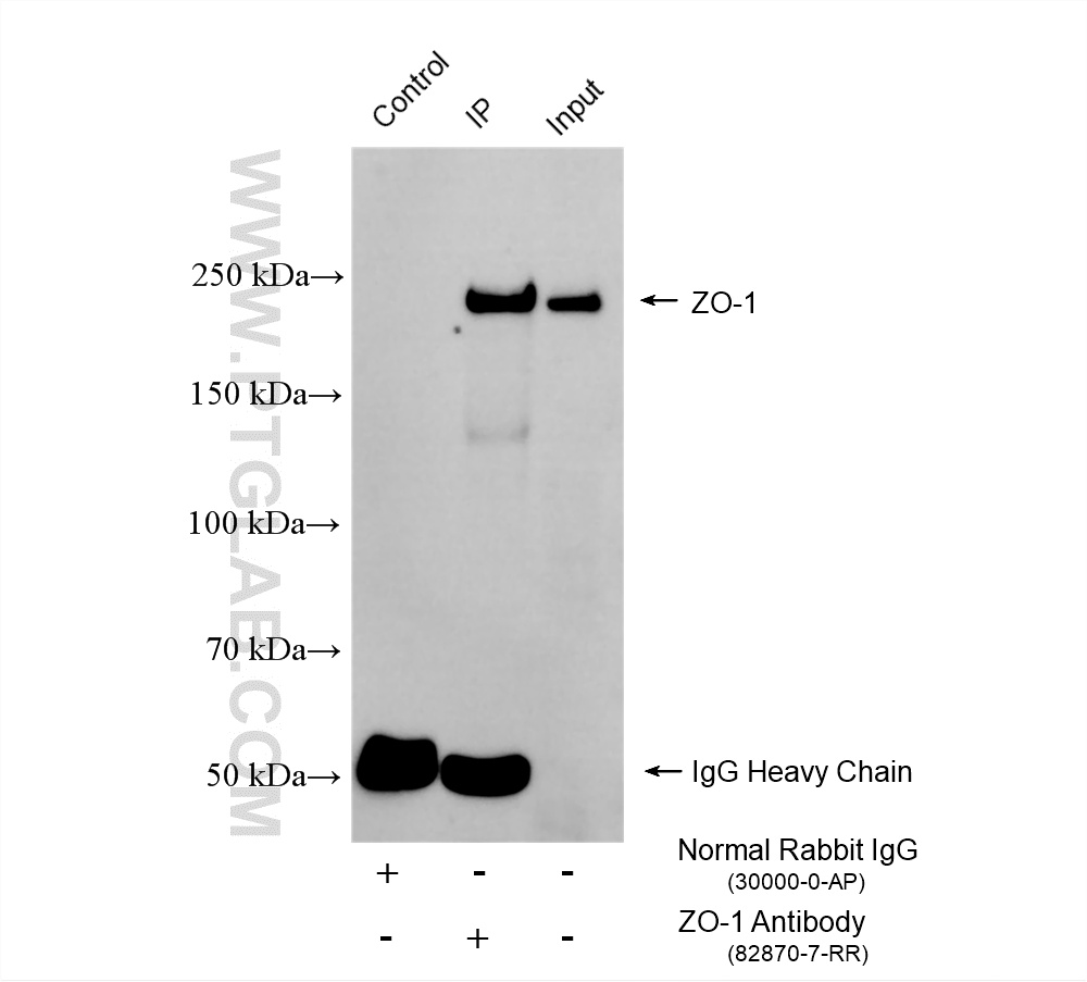IP experiment of HEK-293 using 82870-7-RR