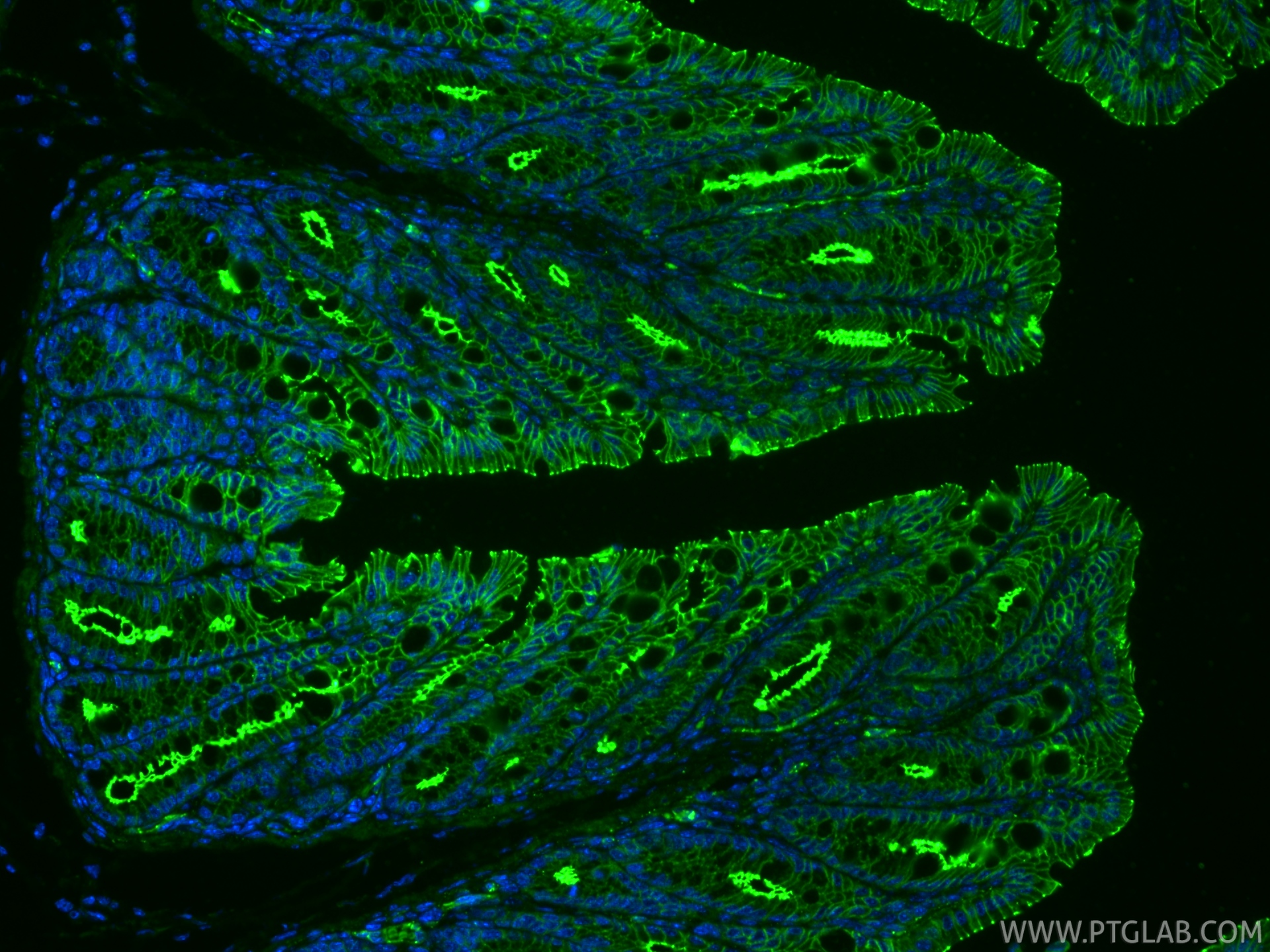 IF Staining of mouse colon using RMX00002 IF Staining of mouse colon using RMX00002