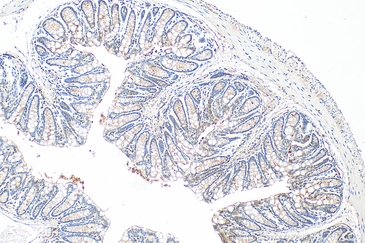 IHC staining of mouse colon using RMX00002