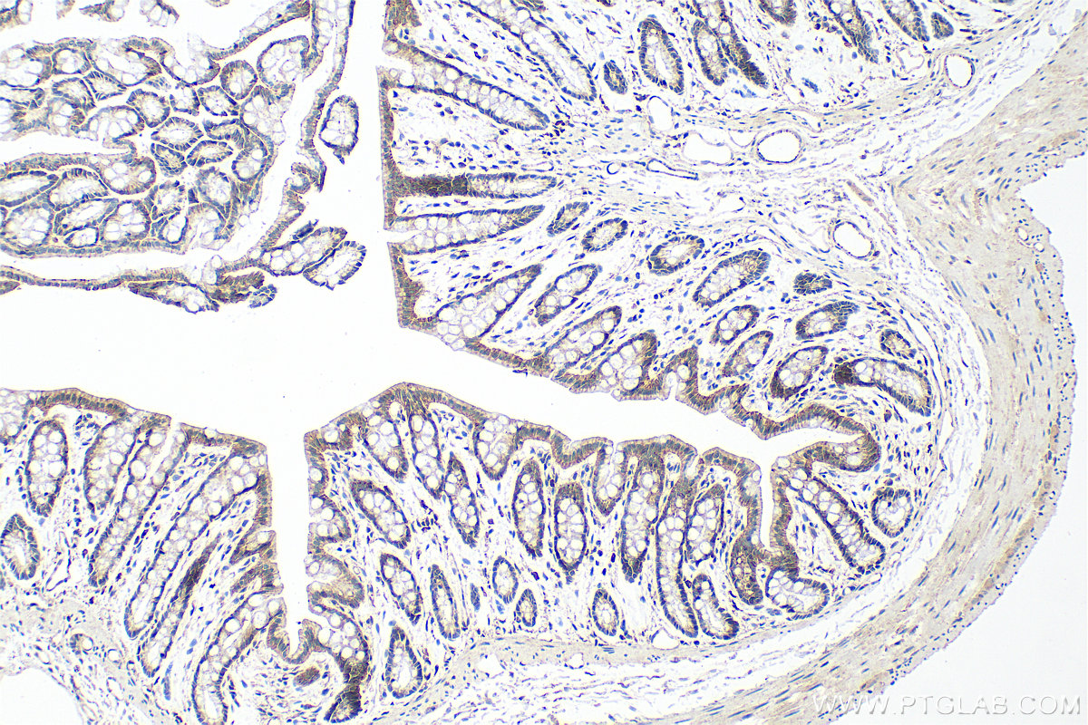 IHC staining of rat colon using RMX00002