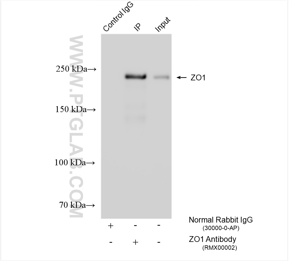 IP experiment of HEK-293 using RMX00002