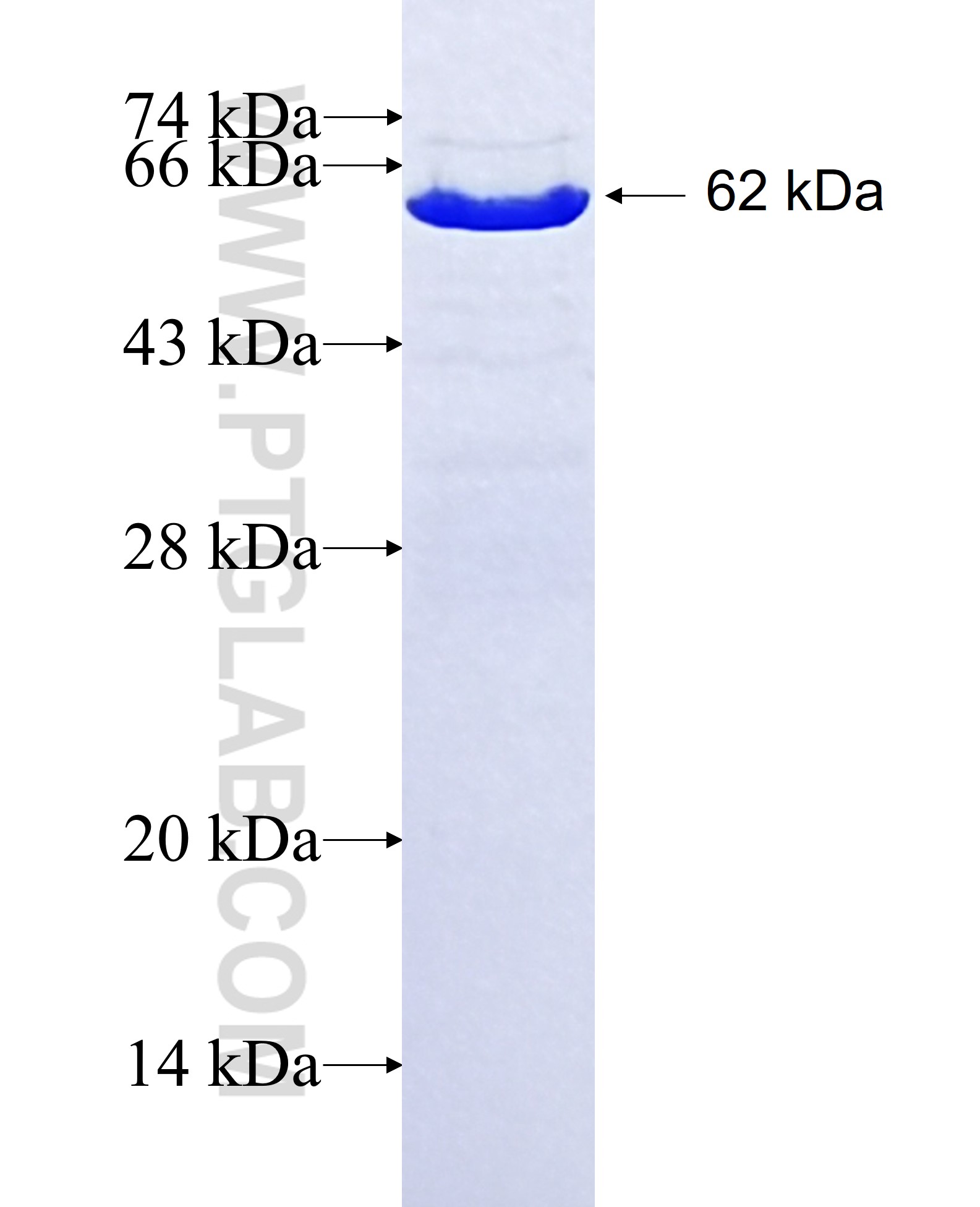 ZO1 fusion protein Ag16454 SDS-PAGE