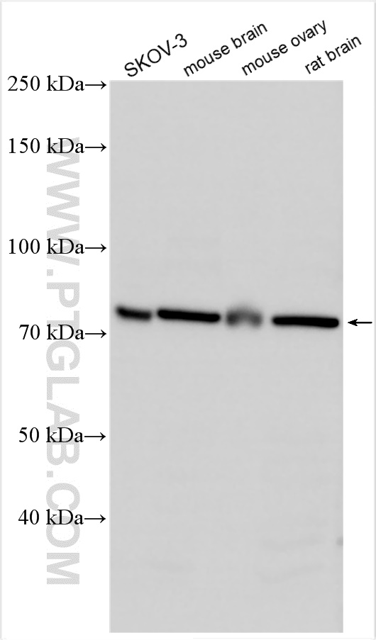 WB analysis using 21832-1-AP