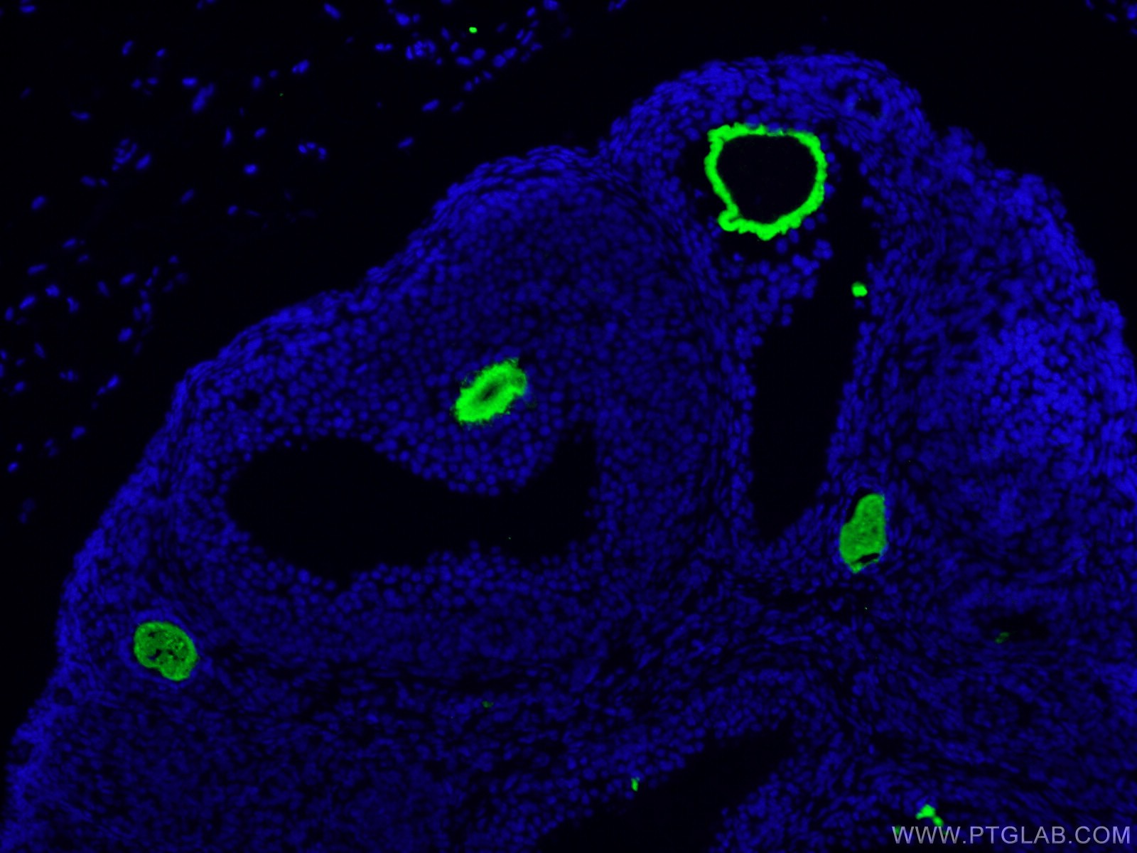 IF Staining of mouse ovary using 21279-1-AP