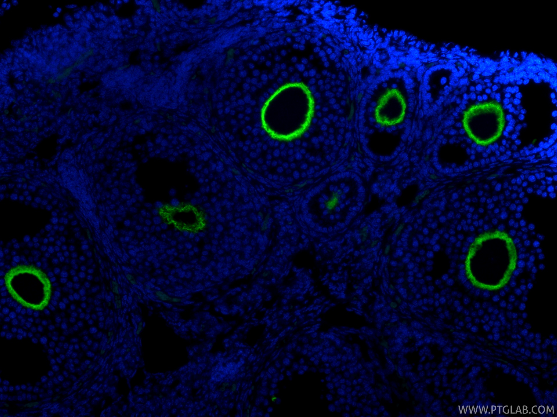 Immunofluorescent analysis of (4% PFA) fixed paraffin-embedded mouse ovary tissue using CoraLite® Plus 488 ZP3 antibody (CL488-85084, Clone: 242729A8 ) at dilution of 1:200. Heat mediated antigen retrieval with Tris-EDTA buffer (pH 9.0). IF Staining of mouse ovary using CL488-85084