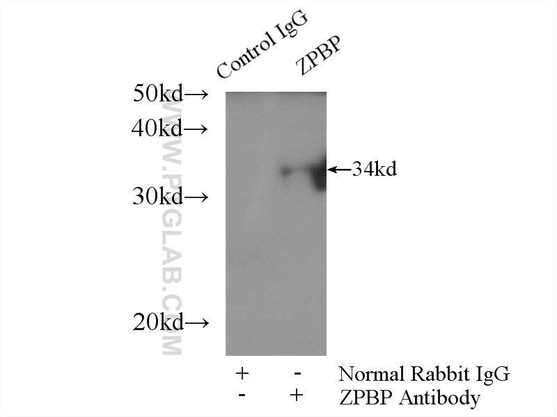 IP experiment of mouse testis using 15835-1-AP