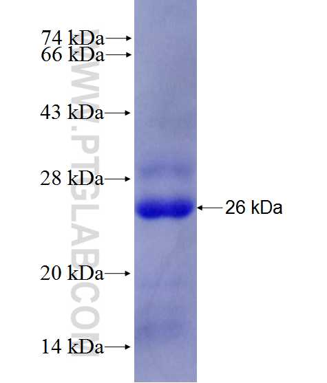 ZPLD1 fusion protein Ag27730 SDS-PAGE ZPLD1 fusion protein Ag27730 SDS-PAGE
