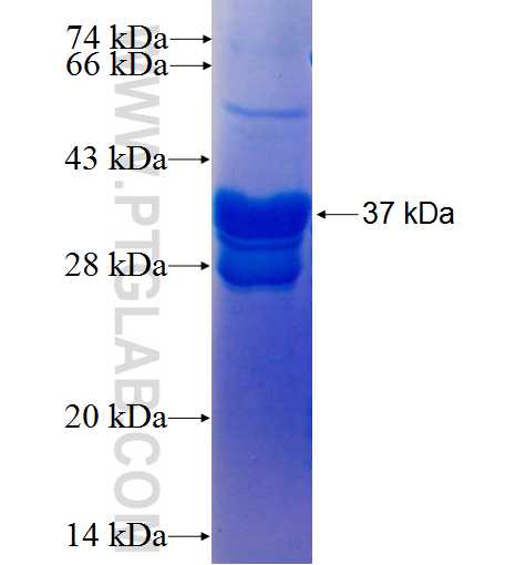 ZRANB1 fusion protein Ag25789 SDS-PAGE