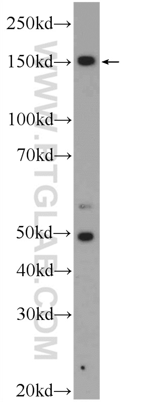 WB analysis of HEK-293 using 23111-1-AP