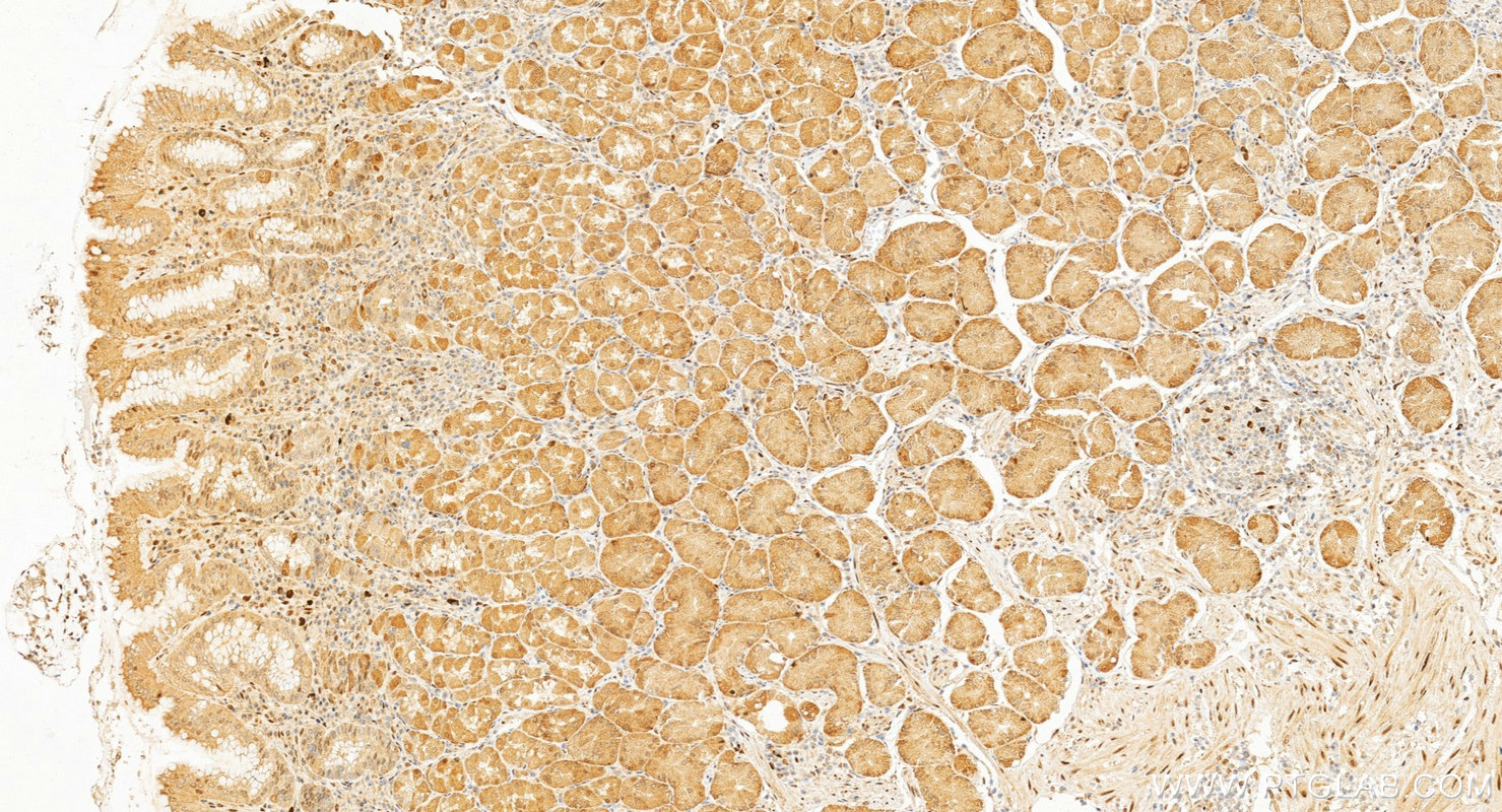 IHC staining of human stomach using 30704-1-AP IHC staining of human stomach using 30704-1-AP