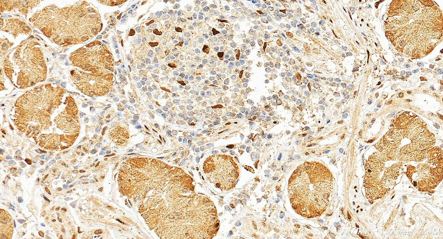 IHC staining of human stomach using 30704-1-AP IHC staining of human stomach using 30704-1-AP