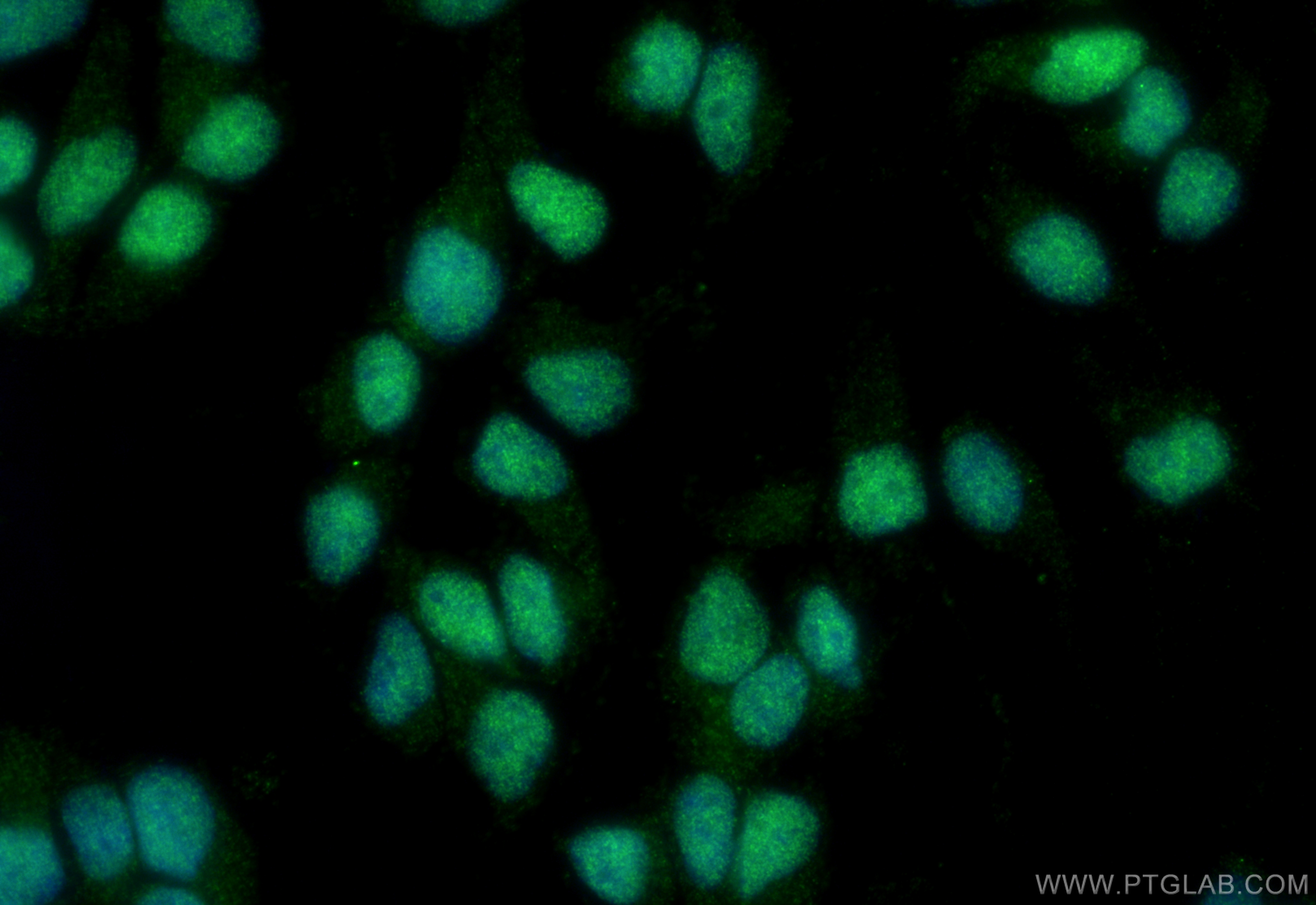 IF Staining of SH-SY5Y using 30704-1-AP