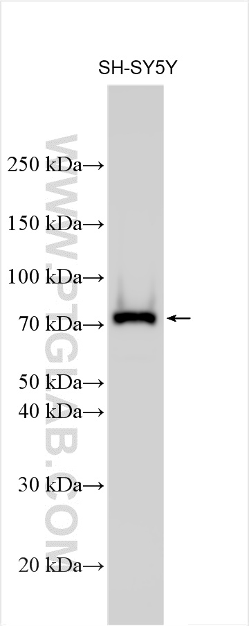 WB analysis using 32581-1-AP
