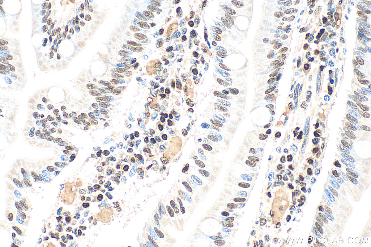 IHC staining of human small intestine using 20855-1-AP