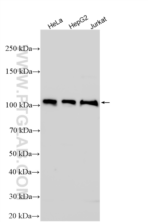 WB analysis using 21630-1-AP (same clone as 21630-1-PBS)