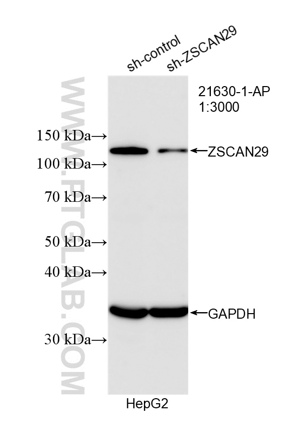 WB analysis of HepG2 using 21630-1-AP (same clone as 21630-1-PBS)
