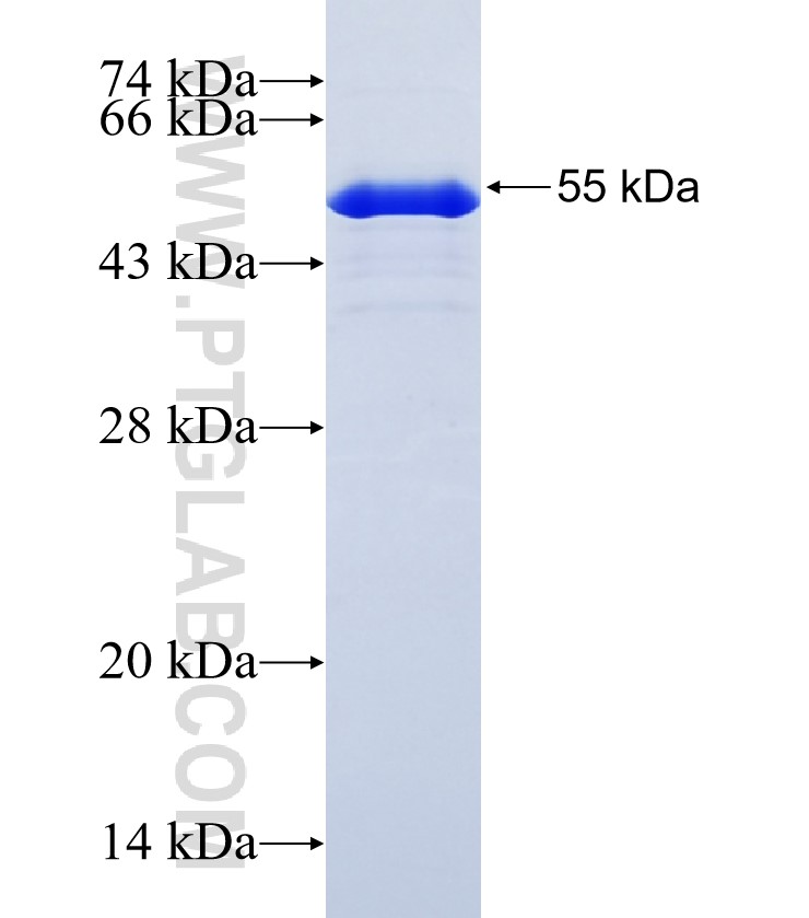 ZSCAN4 fusion protein Ag22134 SDS-PAGE ZSCAN4 fusion protein Ag22134 SDS-PAGE