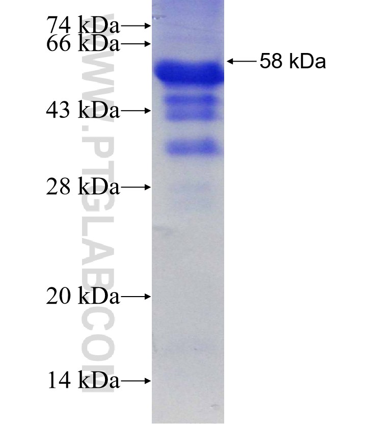 ZSCAN4 fusion protein Ag30139 SDS-PAGE