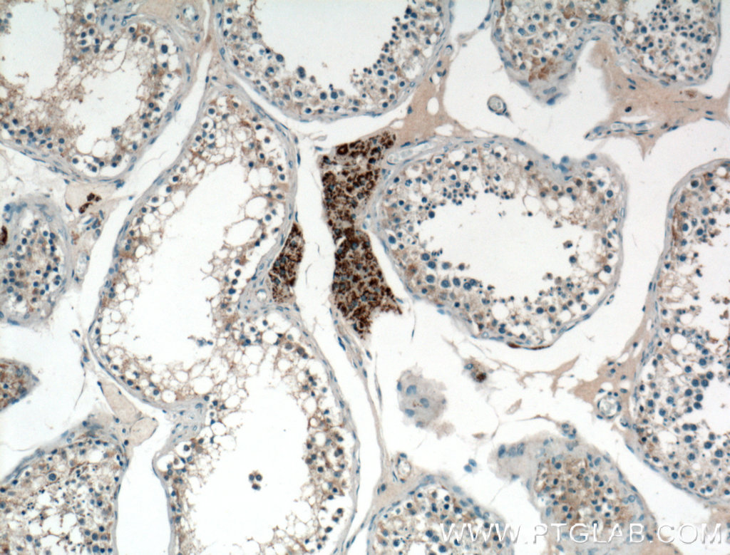 IHC staining of human testis using 19926-1-AP