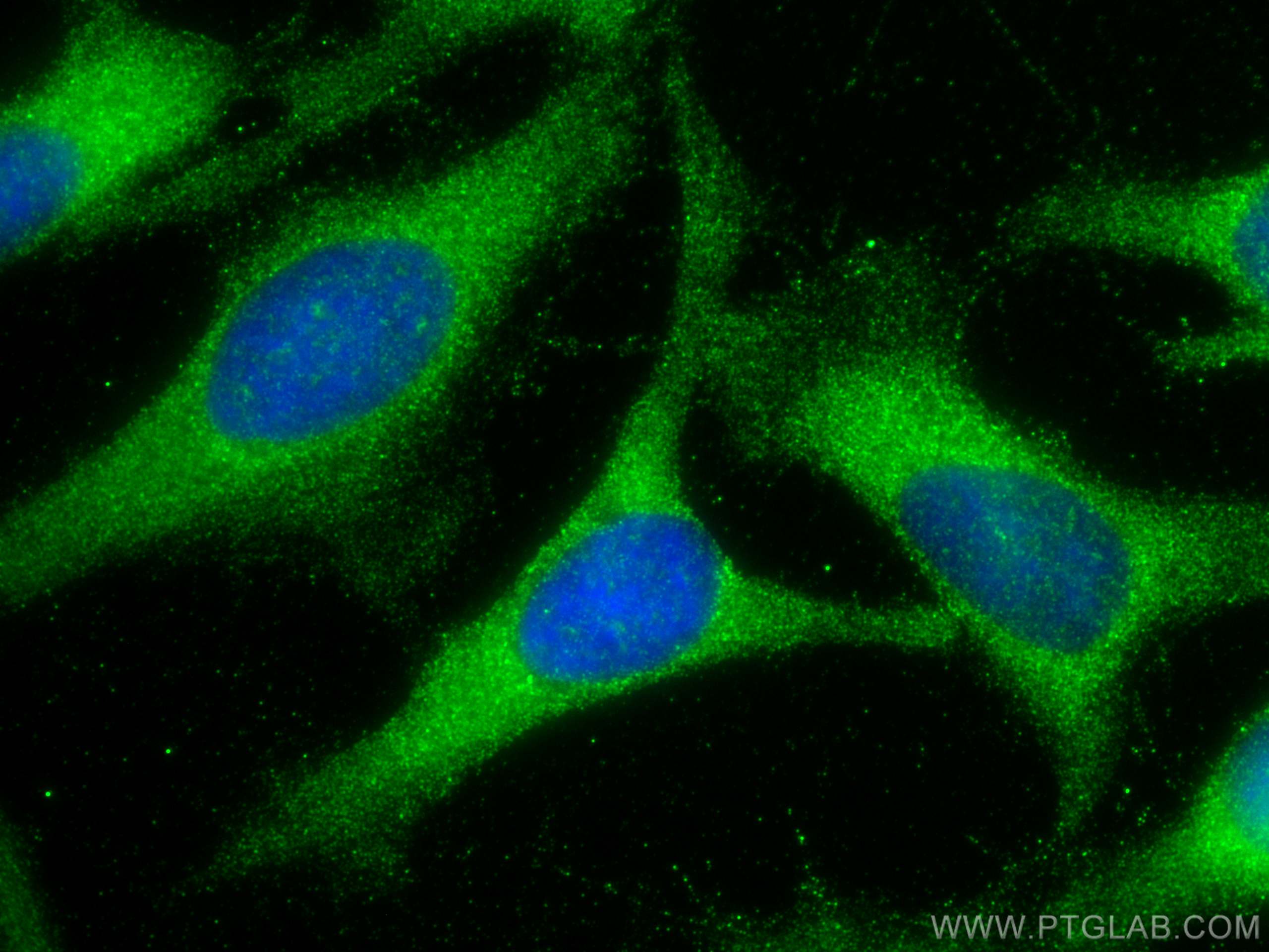 IF Staining of HeLa using 24561-1-AP