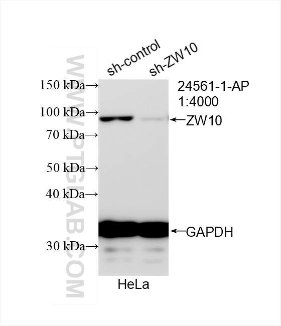 WB analysis of HeLa using 24561-1-AP