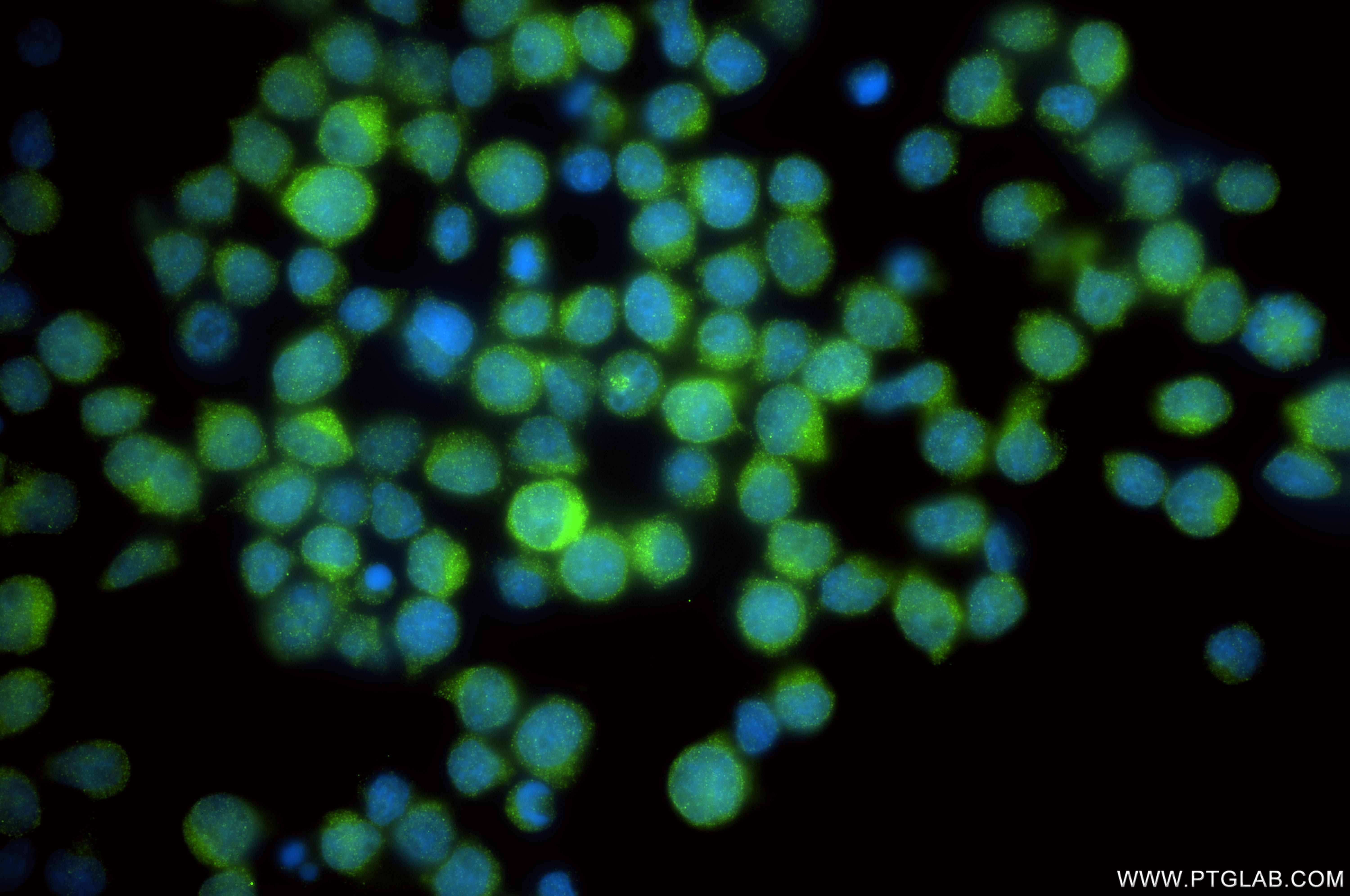 IF Staining of Jurkat using 86726-1-RR