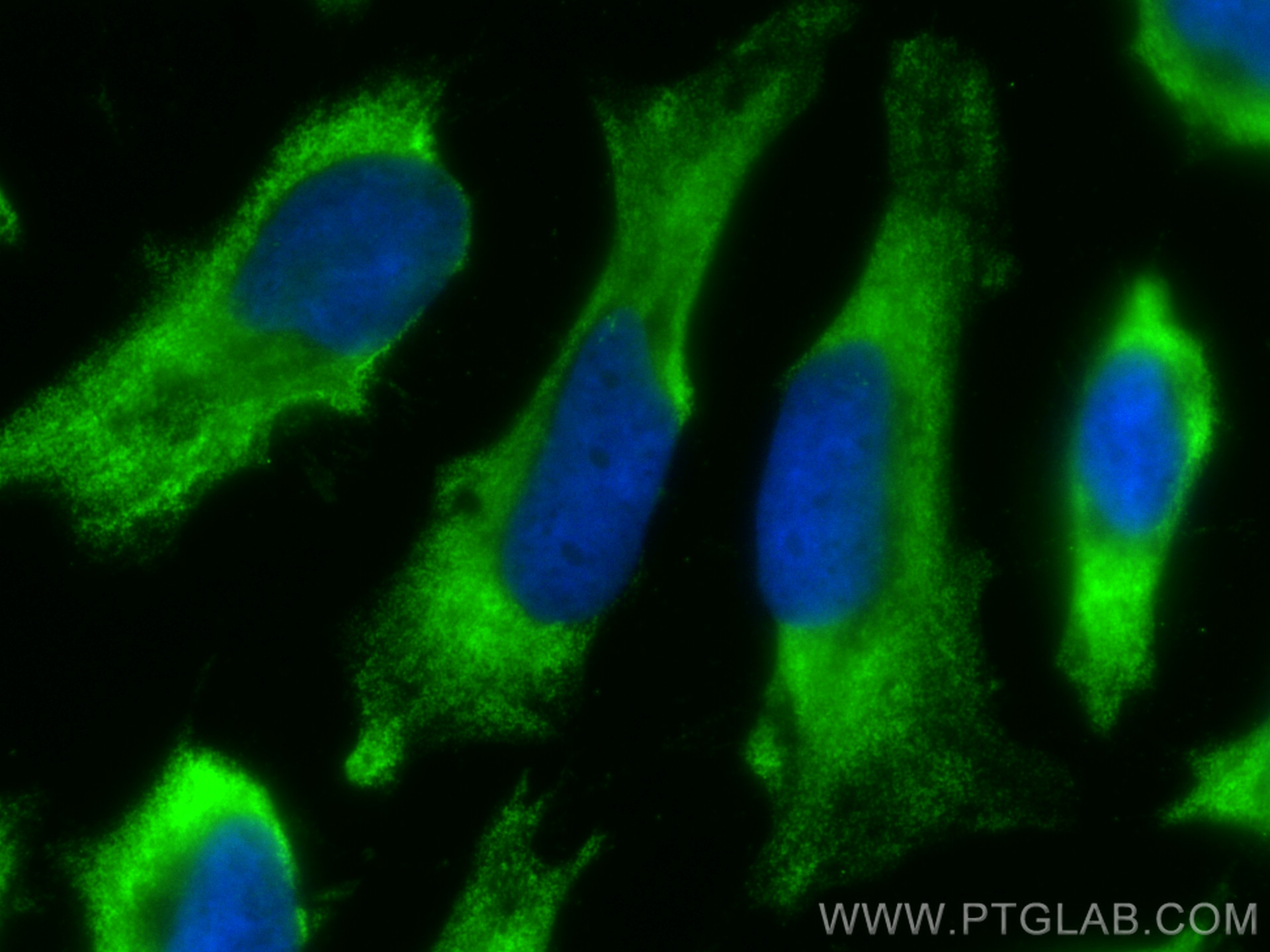 IF Staining of HeLa using CL488-24561