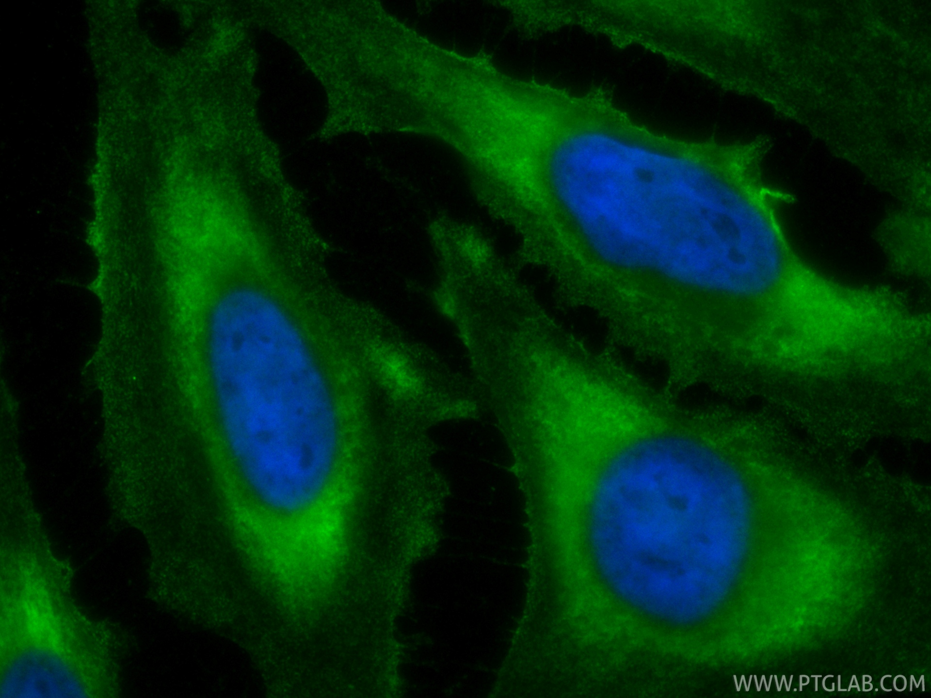 IF Staining of HeLa using CL488-86726