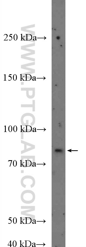 WB analysis of A431 using 26261-1-AP