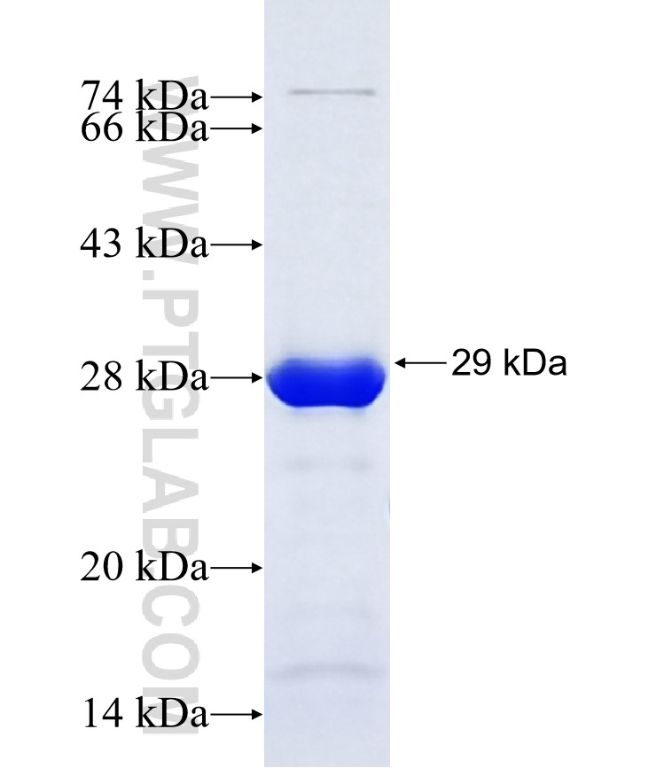 ZXDB fusion protein Ag36956 SDS-PAGE