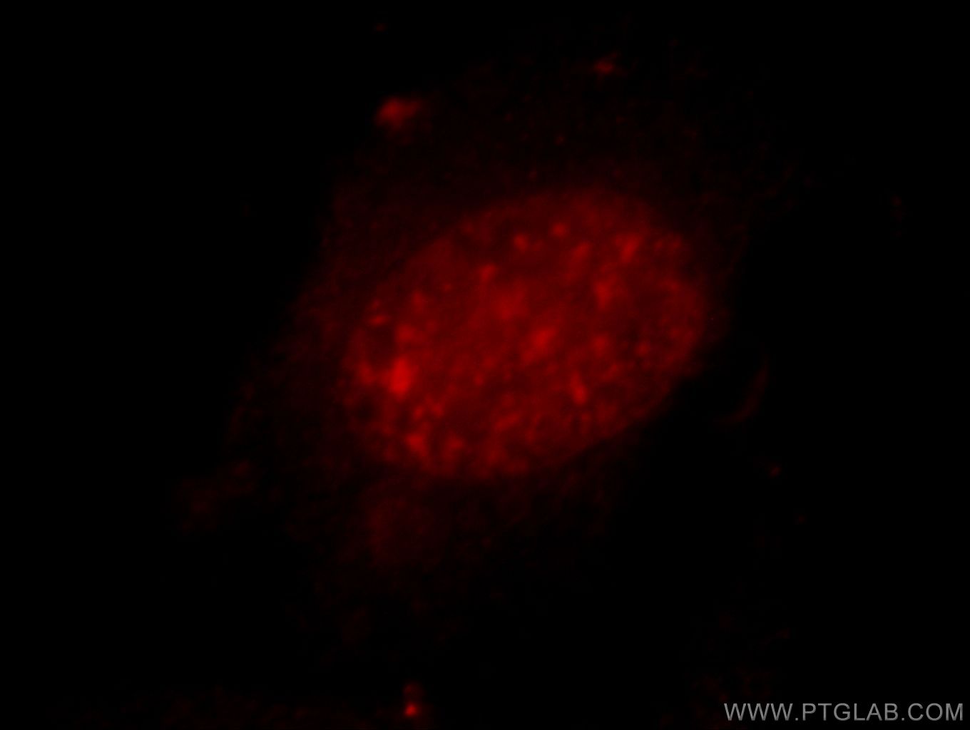 IF Staining of HeLa using 20530-1-AP