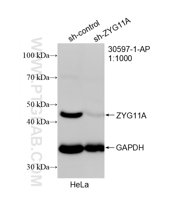 WB result of ZYG11A antibody (30597-1-AP; 1:1000; incubated at room temperature for 1.5 hours) with sh-Control and sh-ZYG11A transfected HeLa cells. WB analysis of HeLa using 30597-1-AP